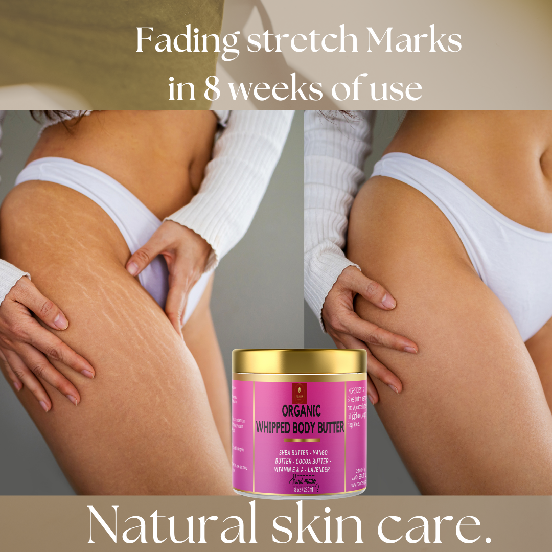 BODY BUTTER CREAM FOR DRY SKIN, COCOA BUTTER BODY CREAM WITH SHEA BUTTER AND COCONUT OIL, deeply moisturizing, nourishing and reducing appearance of Strech Marks. 8 fl oz